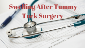 Swelling after Tummy Tuck