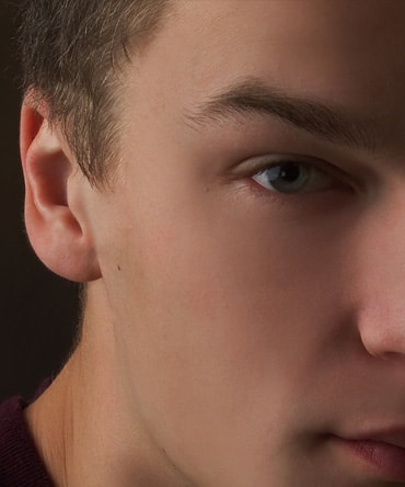 1761151402_otoplasty-featured1