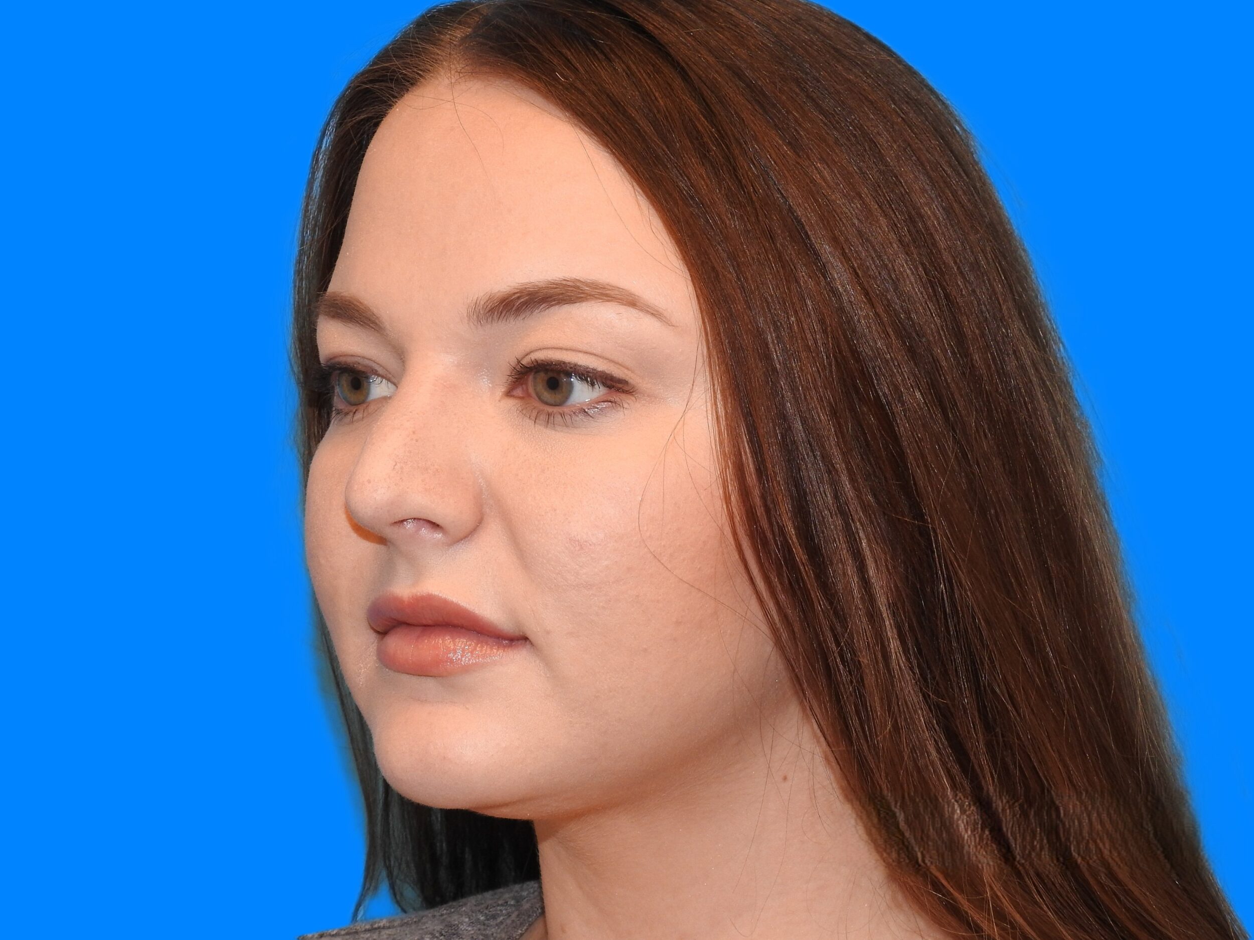 After Image: Patient Case #0102 - left-front-oblique