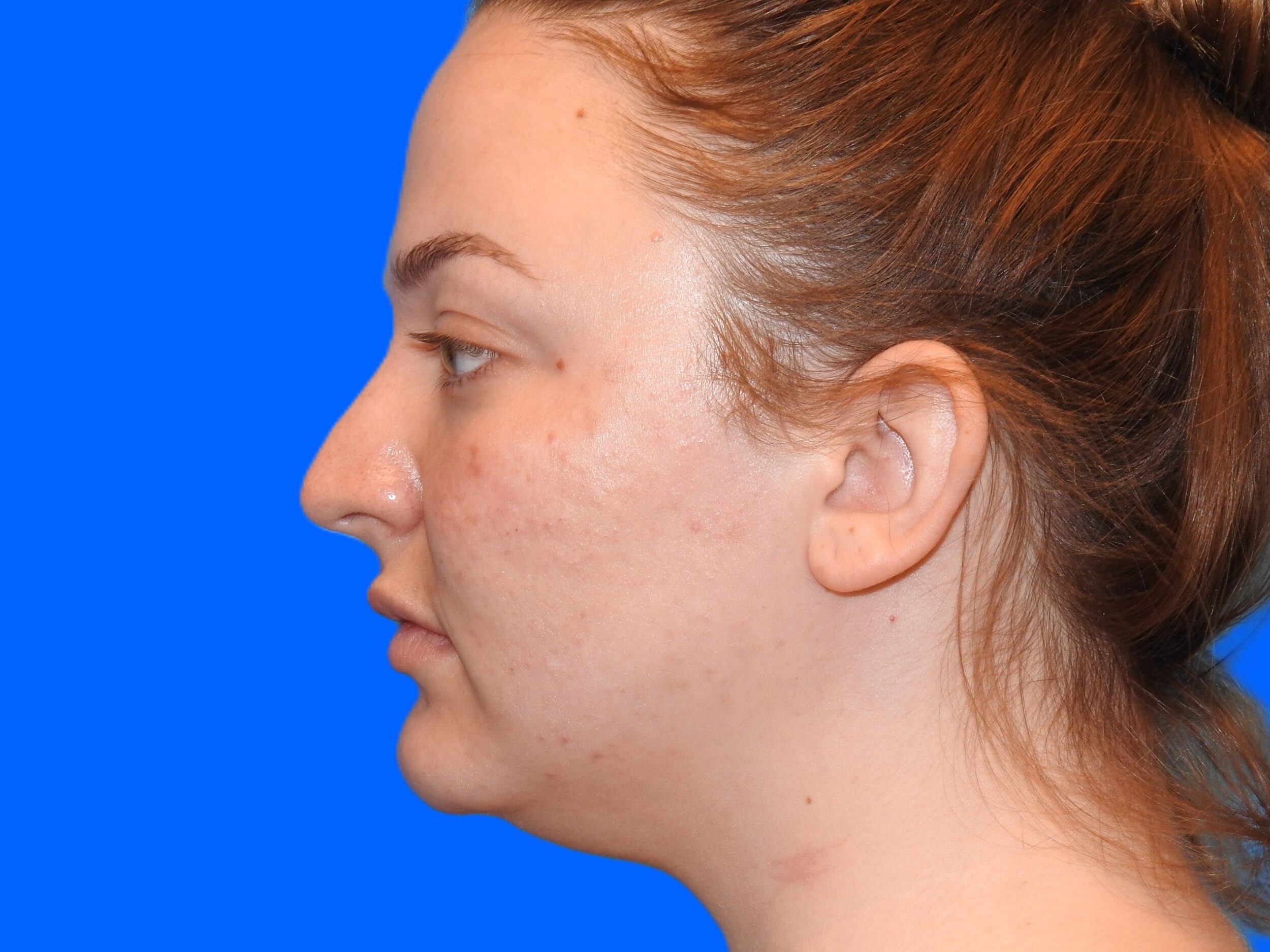 Before Image: Patient Case #0102 - left-side