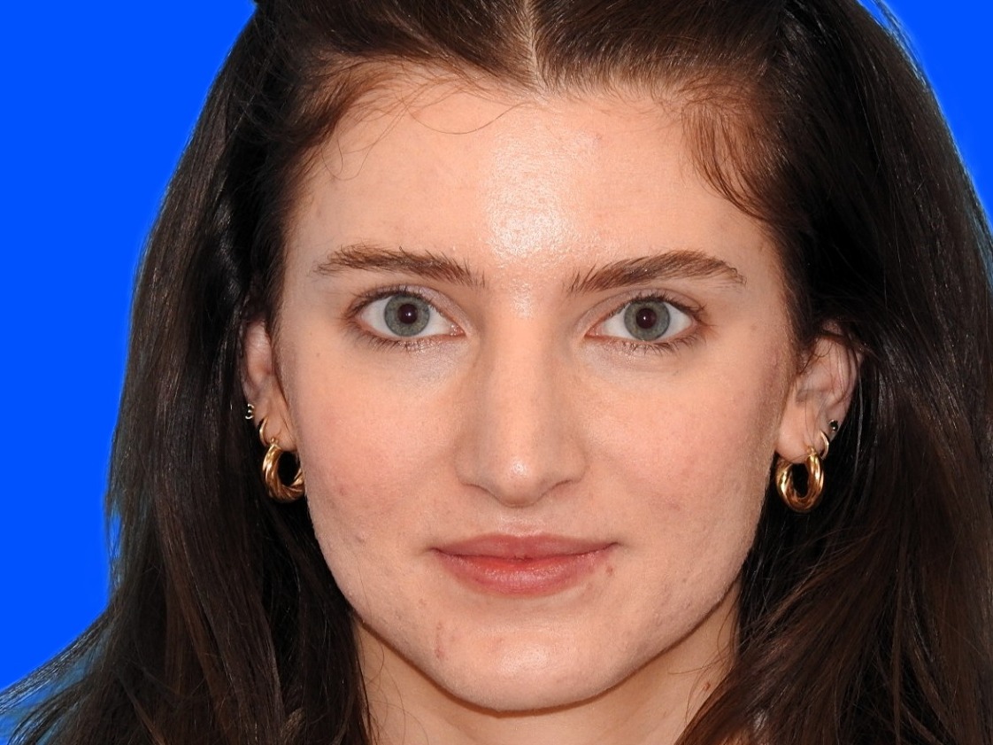 After Image: Patient Case #0109 - front