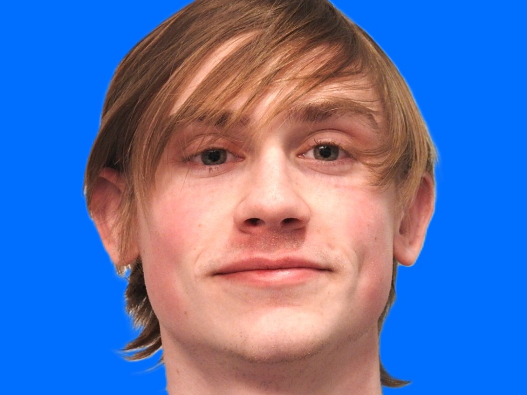 After Image: Patient Case #0117 - front