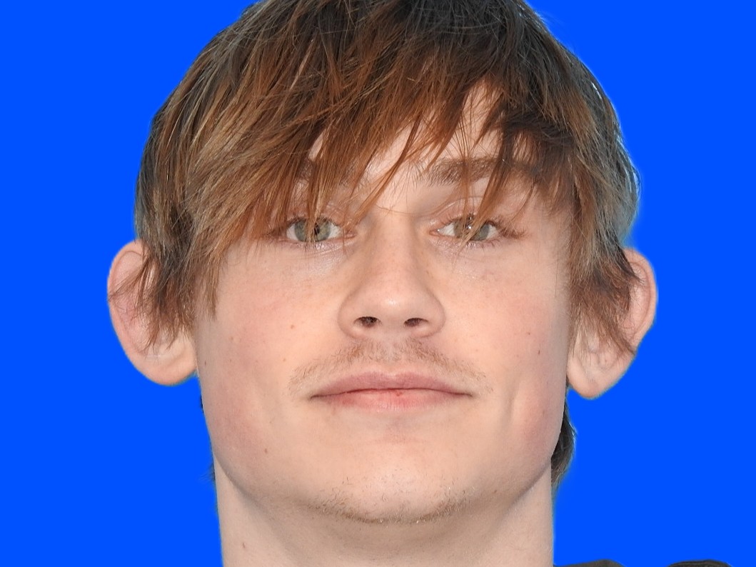 Before Image: Patient Case #0117 - front