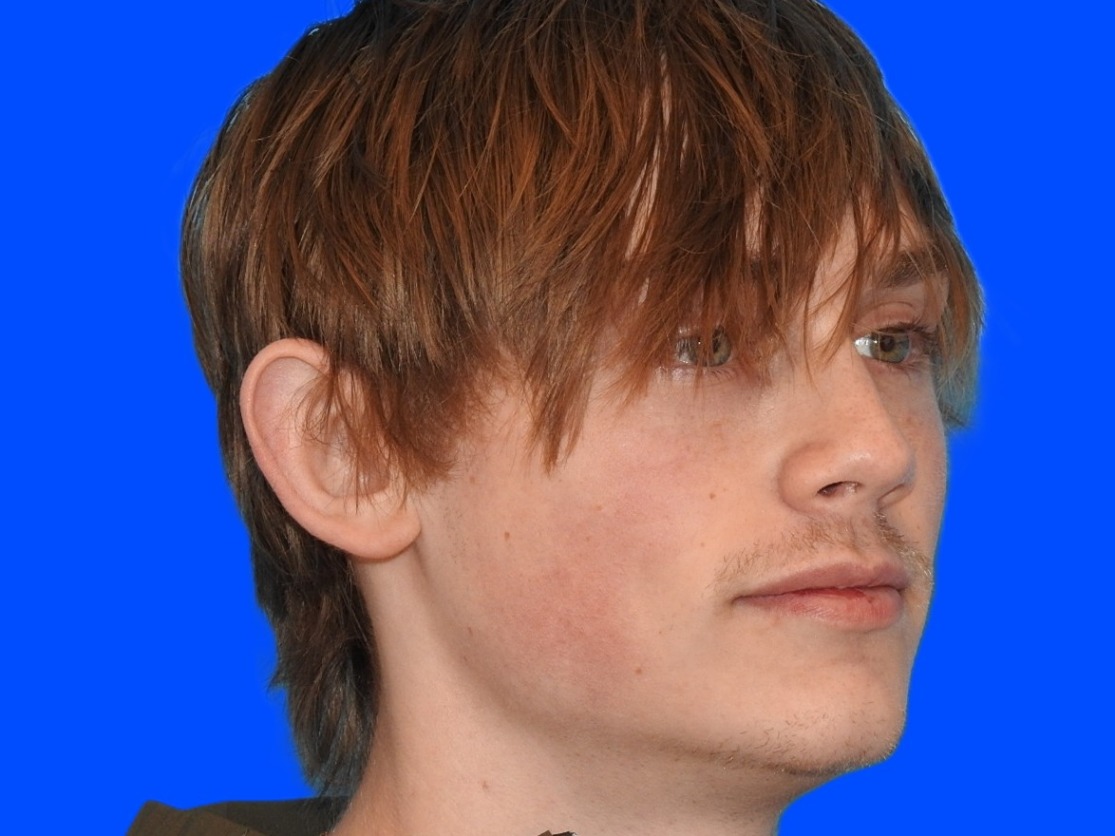 Before Image: Patient Case #0117 - right-front-oblique