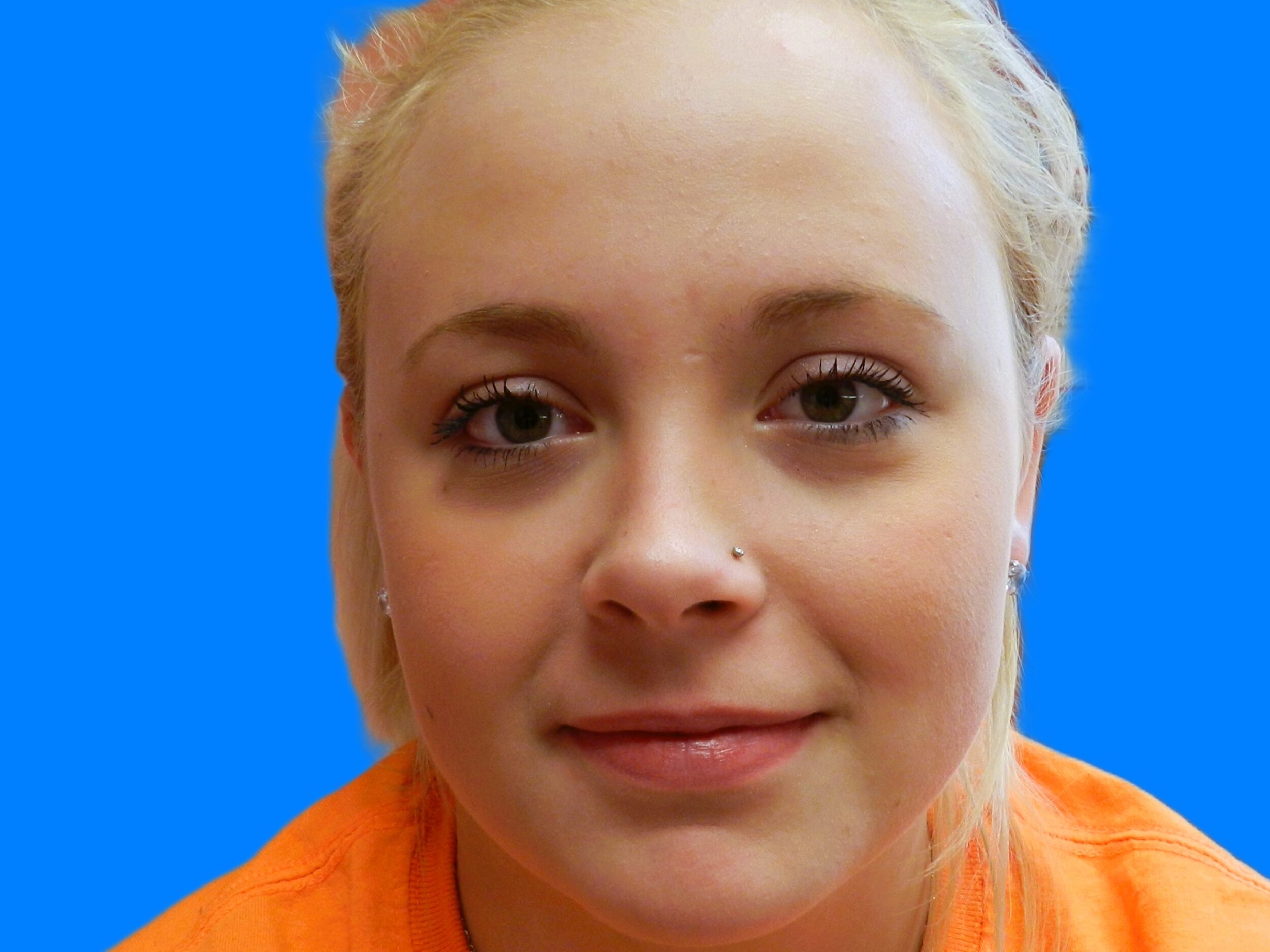 After Image: Patient Case #0118 - front