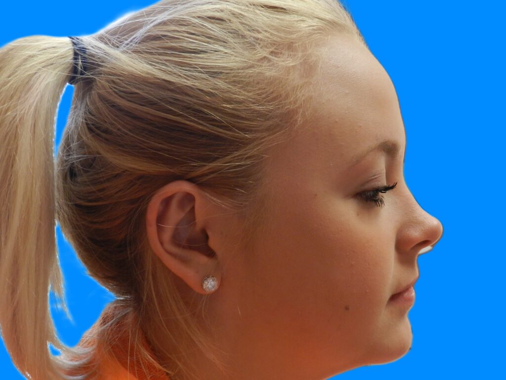 After Image: Patient Case #0118 - right-side