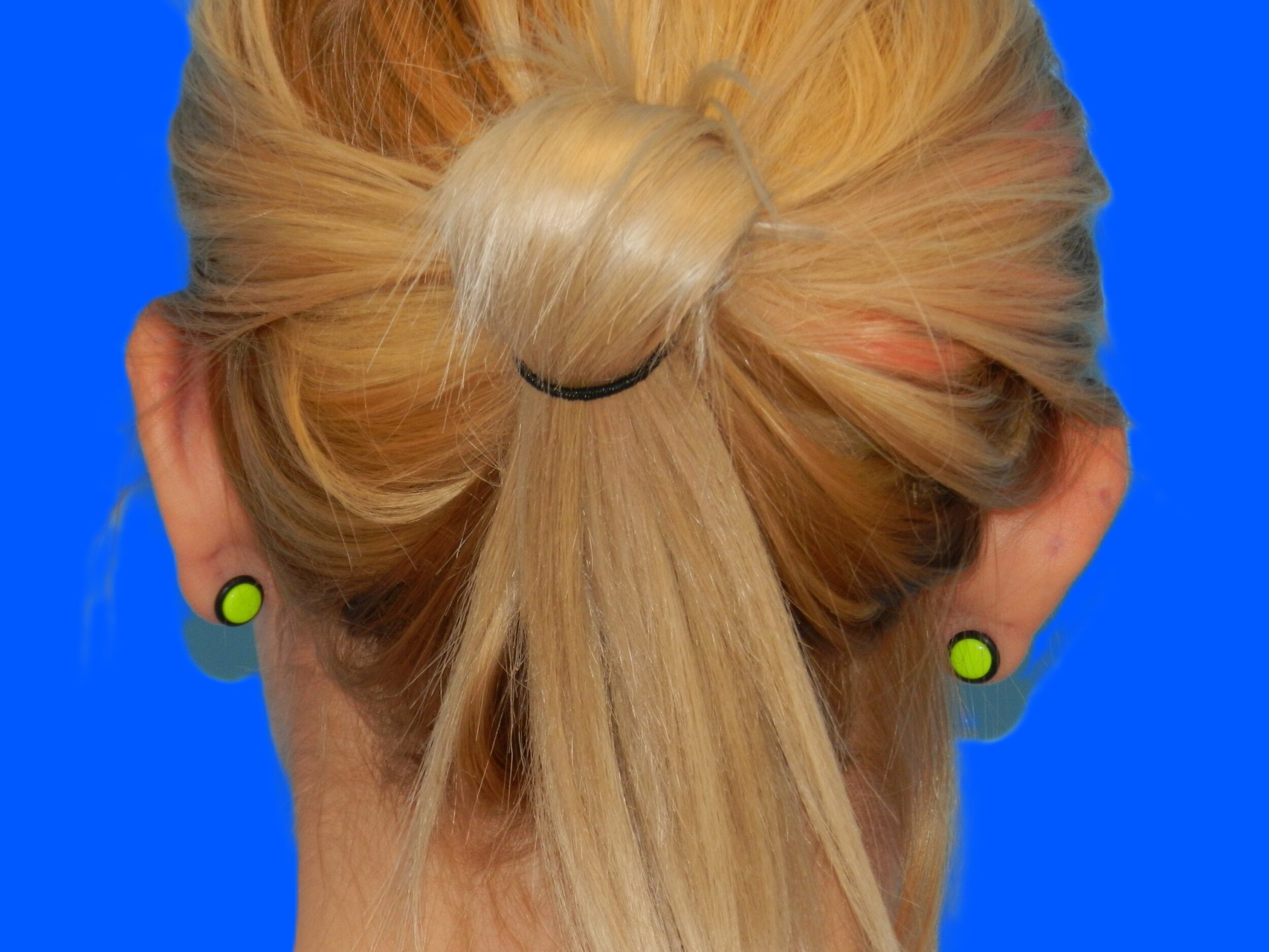 Before Image: Patient Case #0118 - back