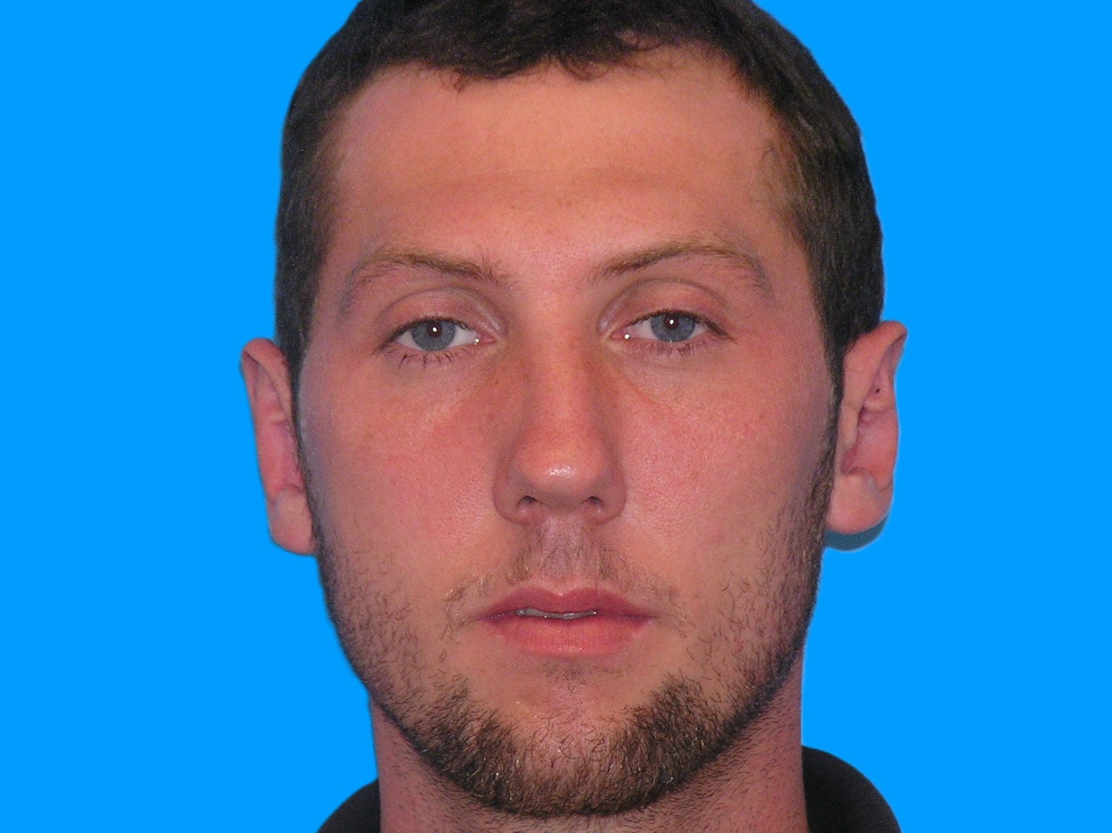 After Image: Patient Case #0120 - front