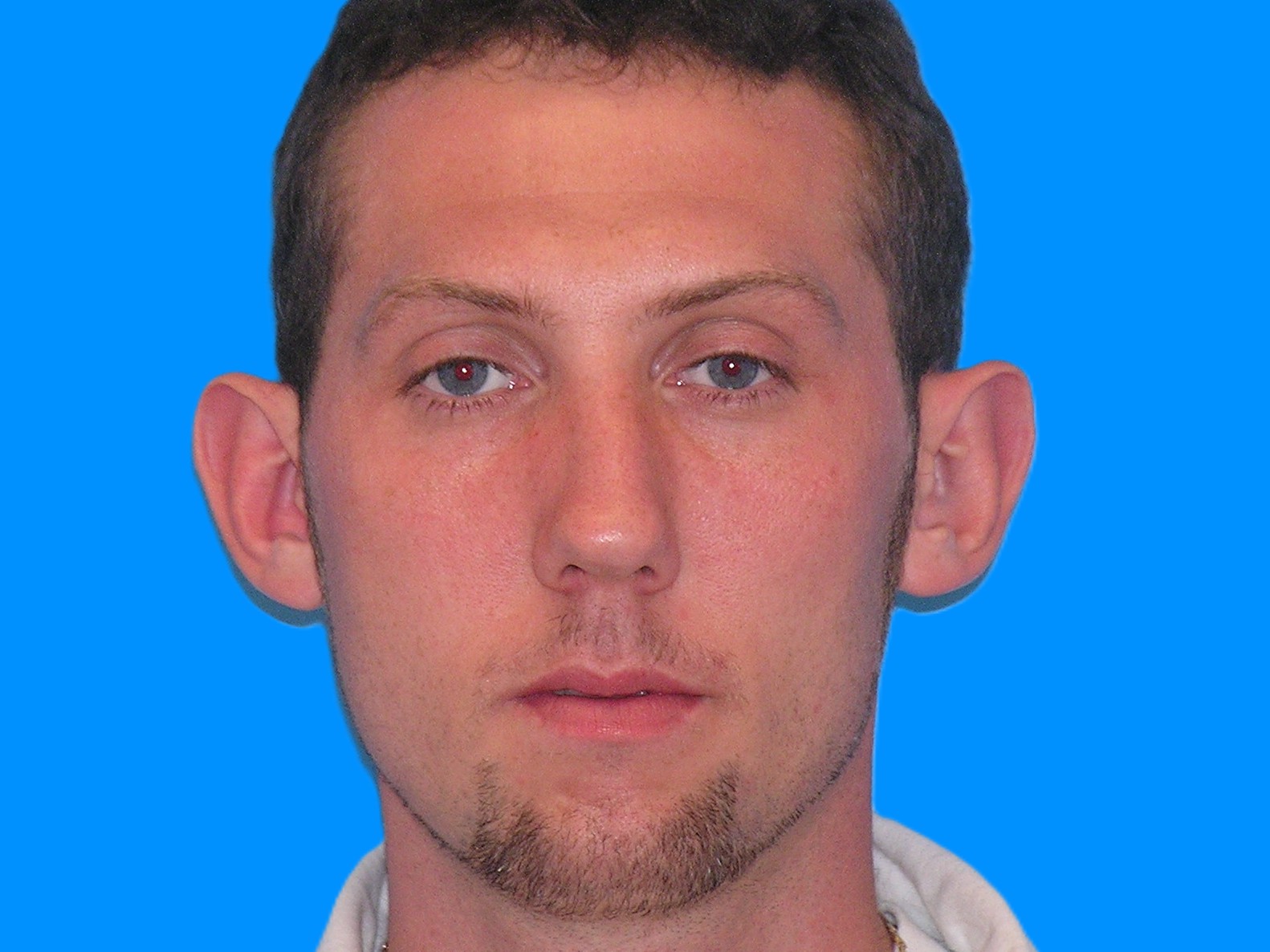 Before Image: Patient Case #0120 - front