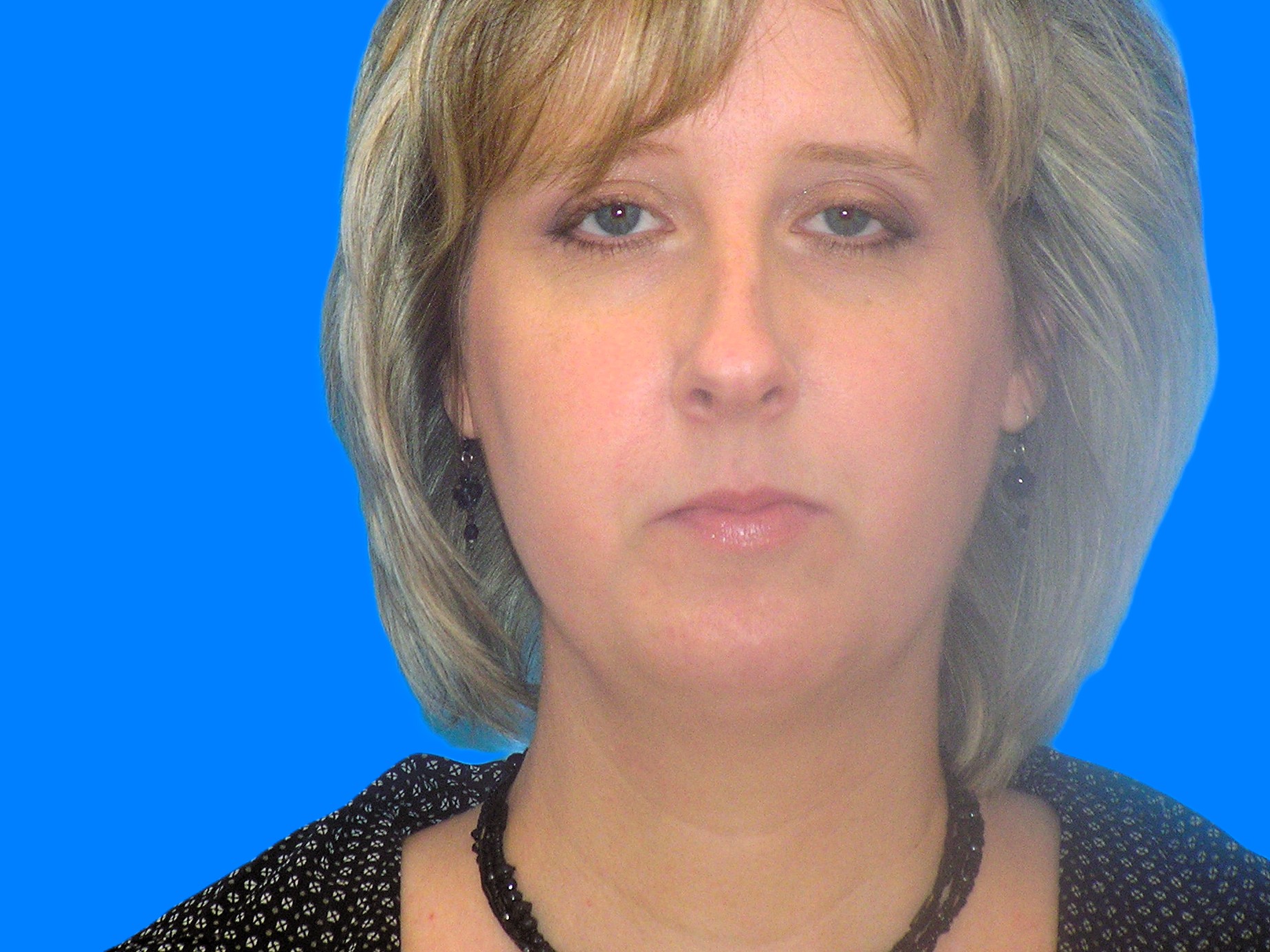 Before Image: Patient Case #0126 - front