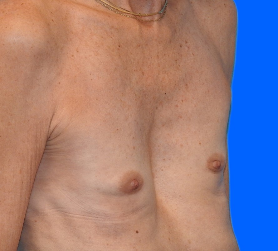 Before Image: Patient Case #0159 - right-front-oblique