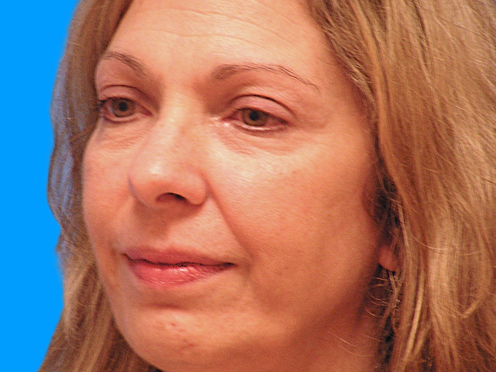 Before Image: Patient Case #1348 - left-front-oblique