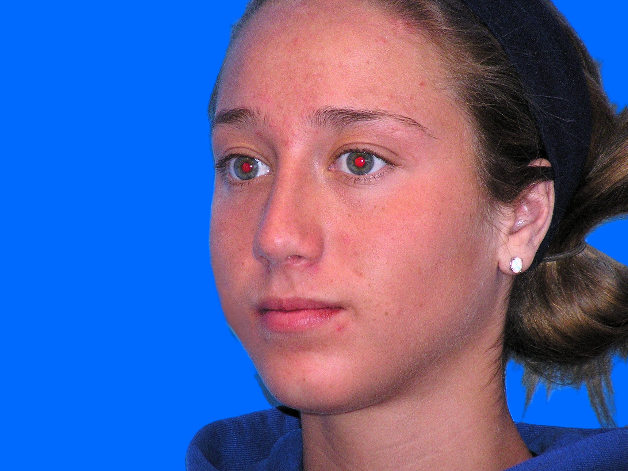 After Image: Patient Case #1402 - left-front-oblique