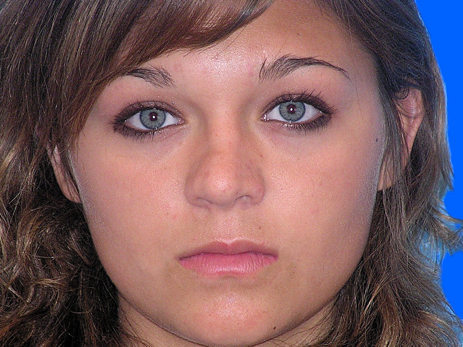 After Image: Patient Case #01406 - front