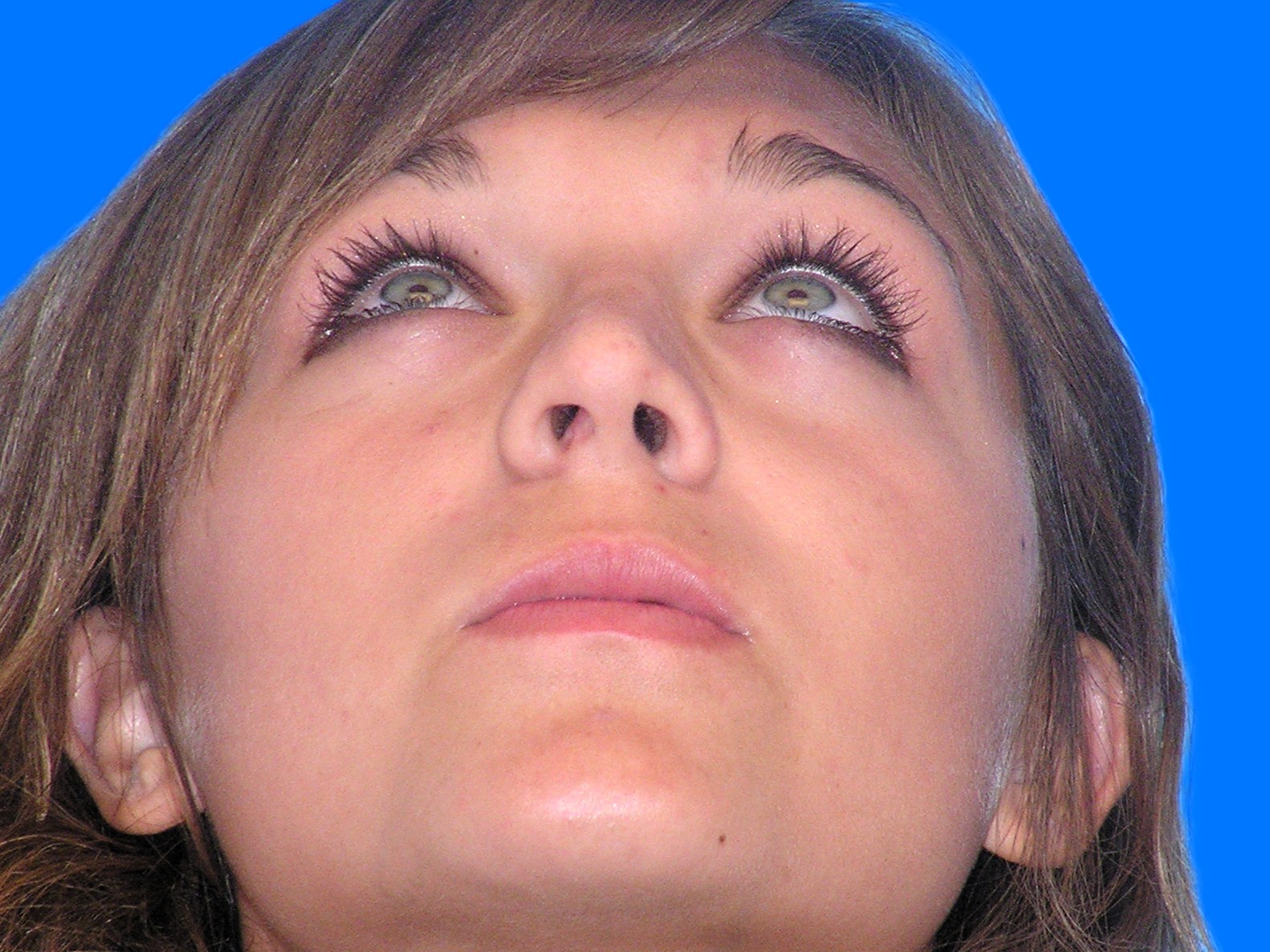 After Image: Patient Case #01406 - front