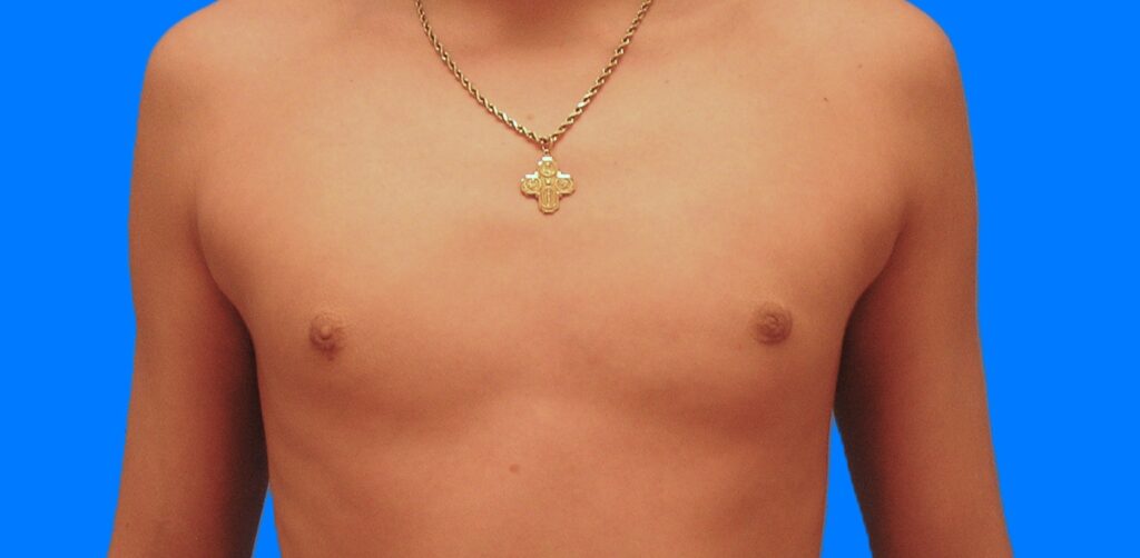 After Image: Patient Case #898 - front