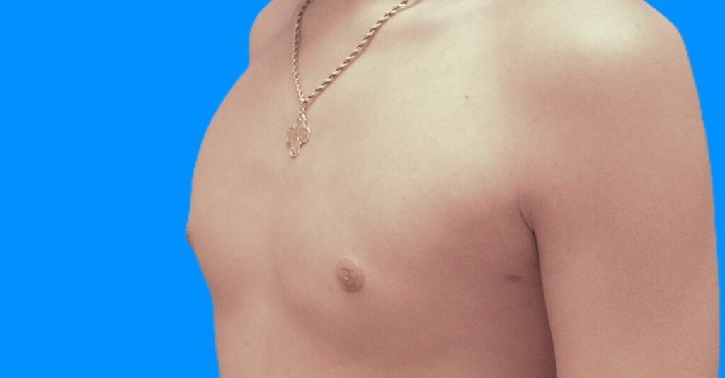 After Image: Patient Case #898 - left-front-oblique