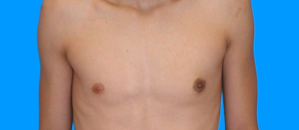 After Image: Patient Case #899 - front