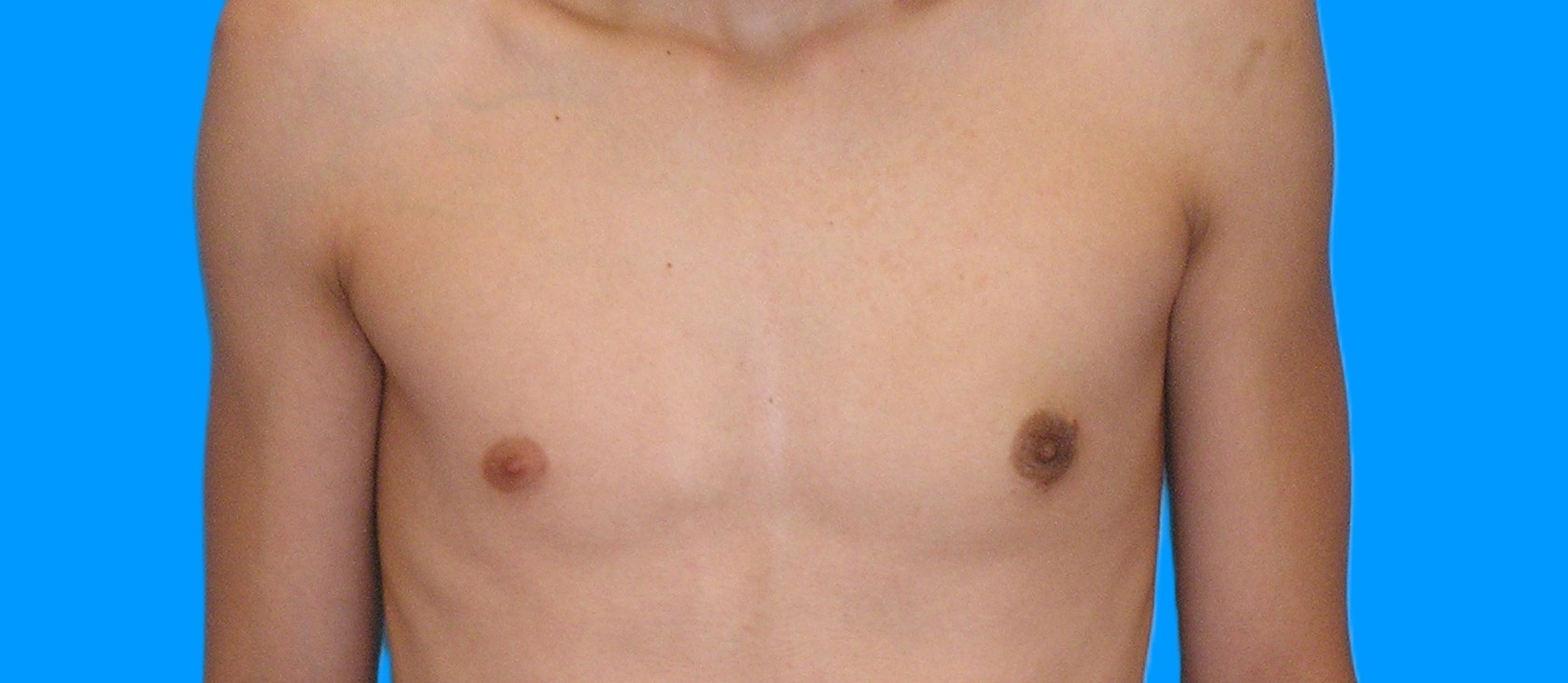 After Image: Patient Case #899 - front