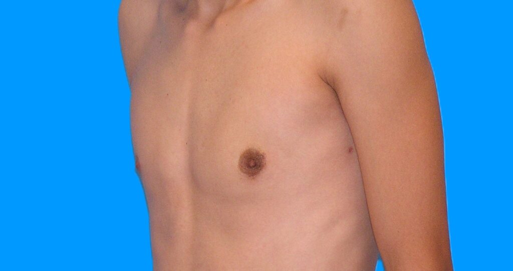 After Image: Patient Case #899 - left-front-oblique