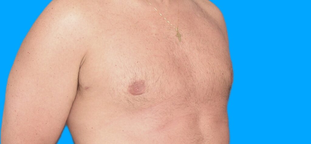 After Image: Patient Case #900 - right-front-oblique