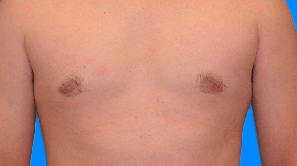 After Image: Patient Case #902 - front