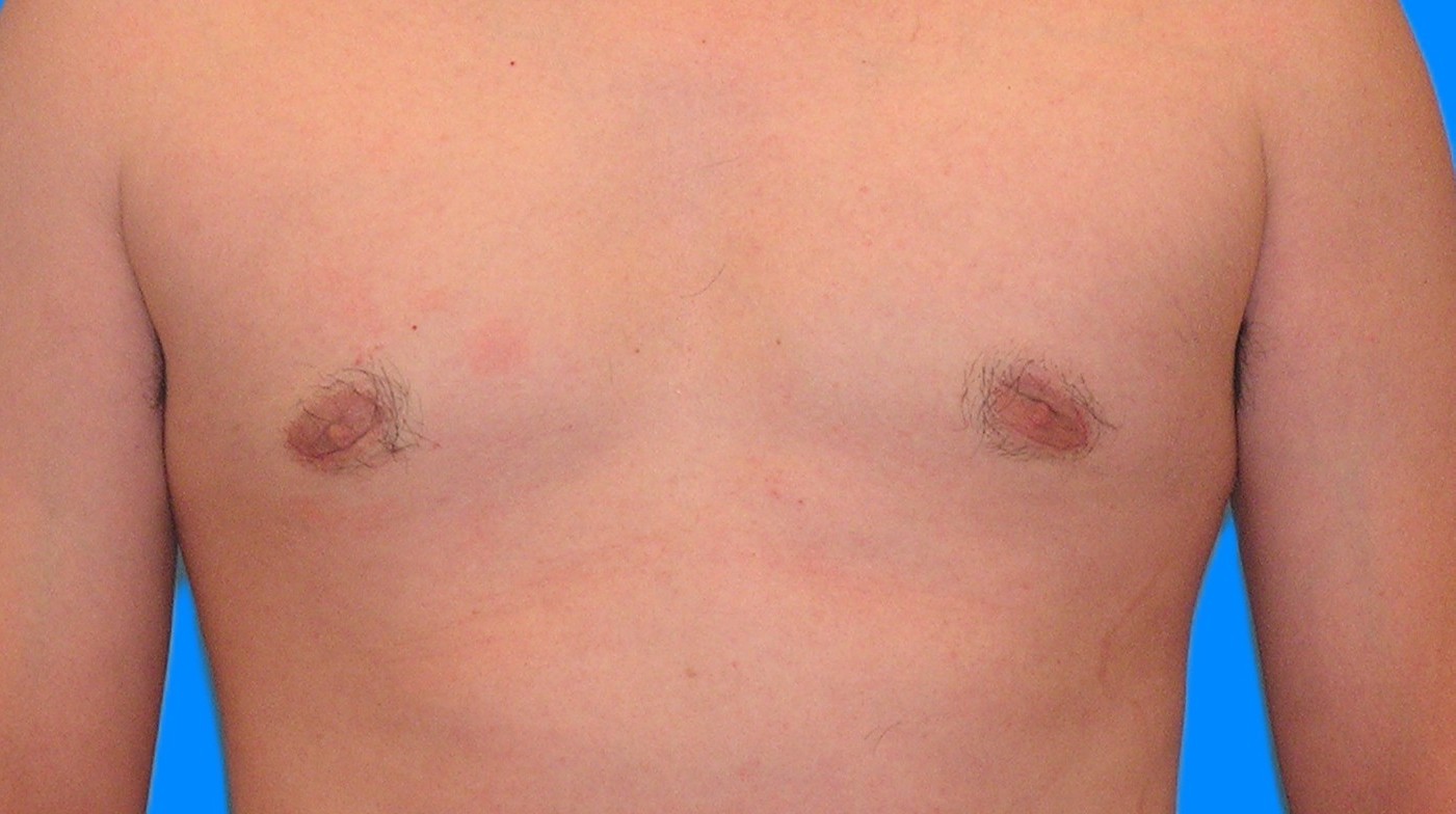 After Image: Patient Case #902 - front