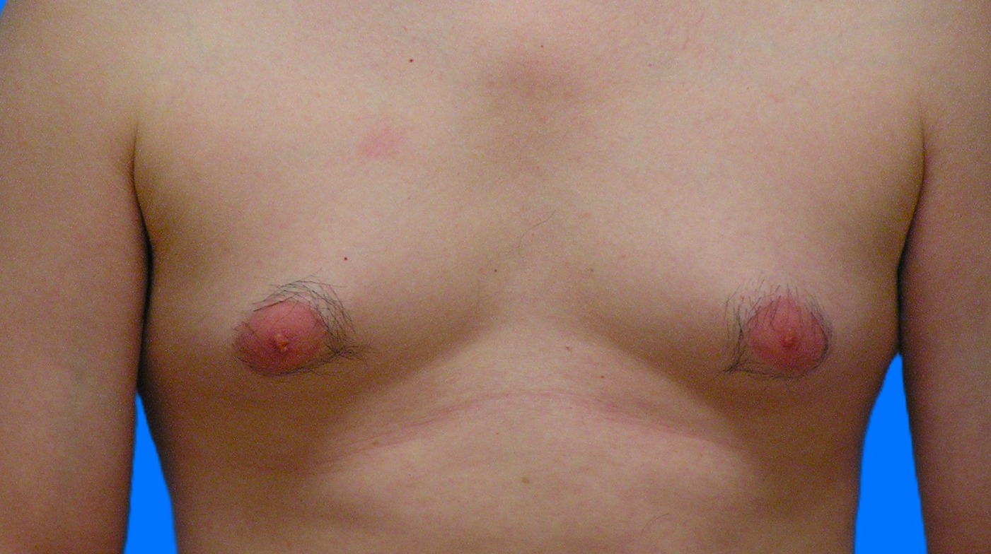 Before Image: Patient Case #902 - front