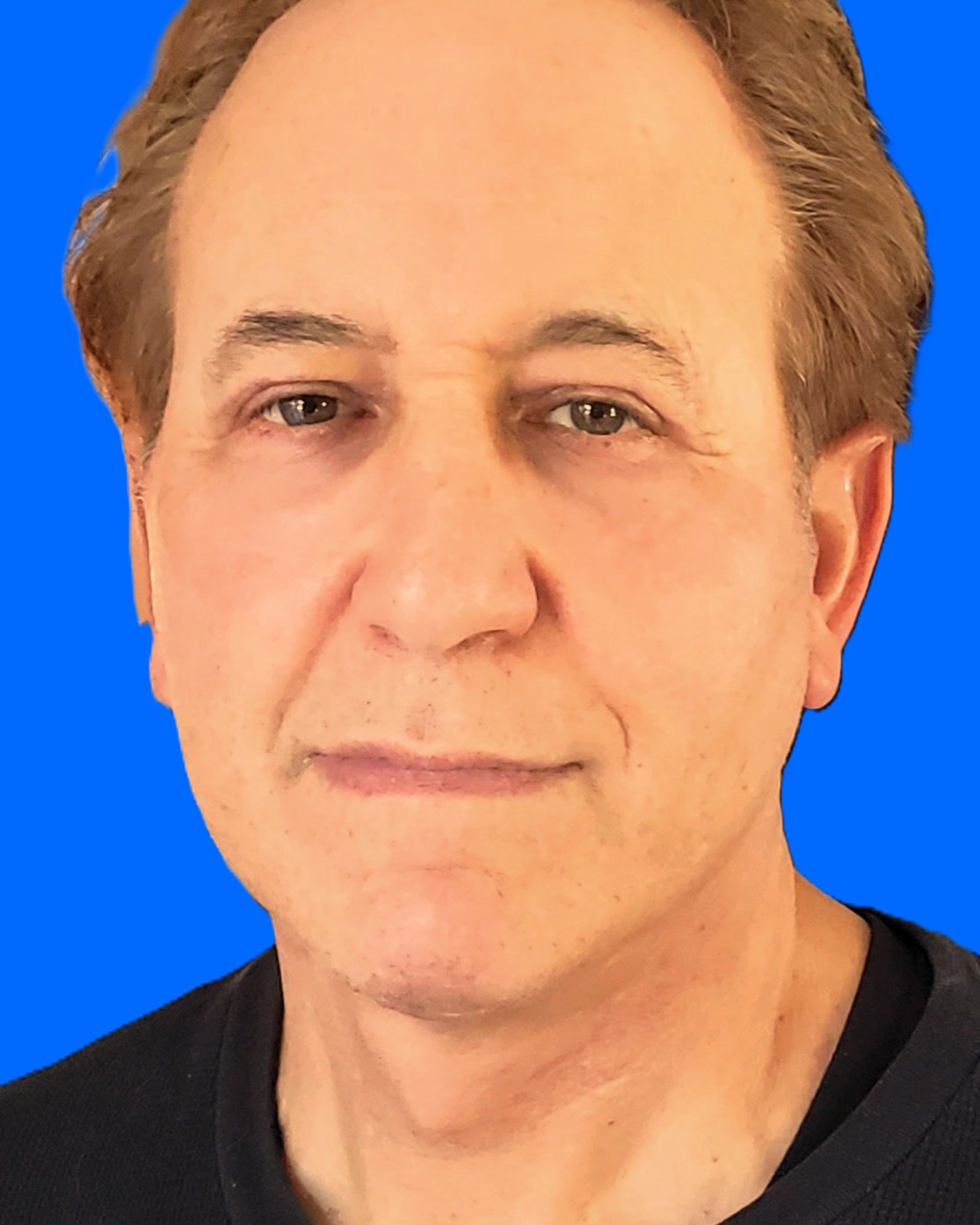 After Image: Patient Case #9250 - front