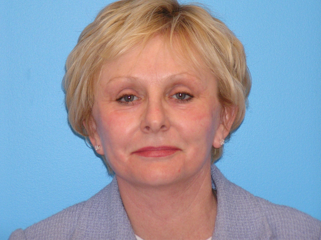 After Image: Patient Case #0122 - front