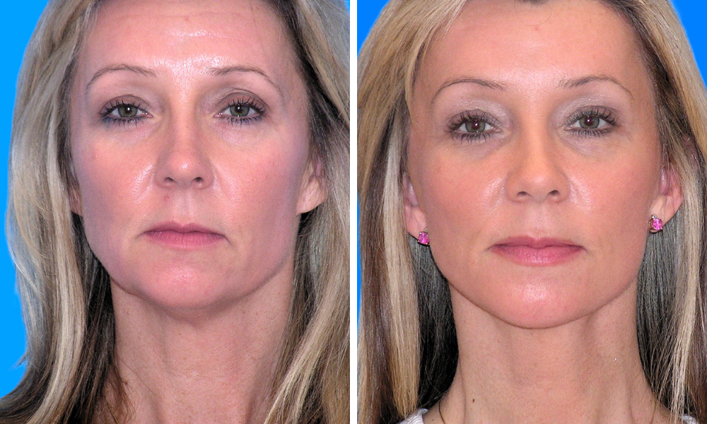 Untitled design (48)