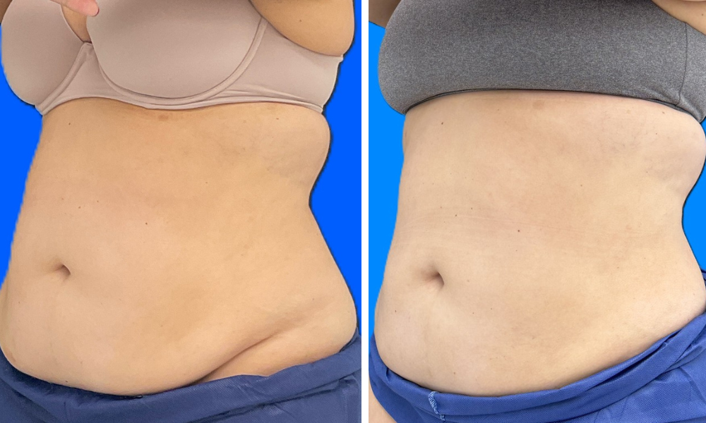 Untitled design (51)