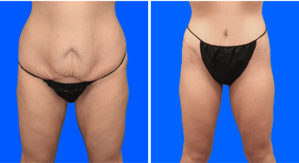 Untitled design (54)