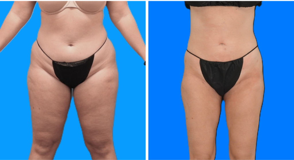 Untitled design (54)