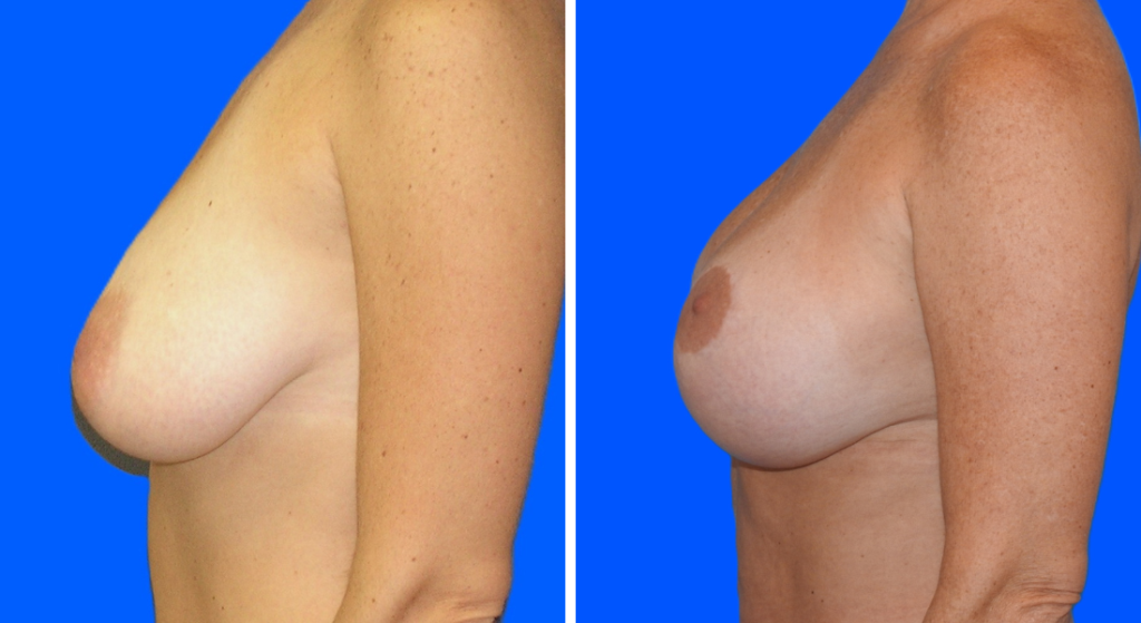 Untitled design (54)