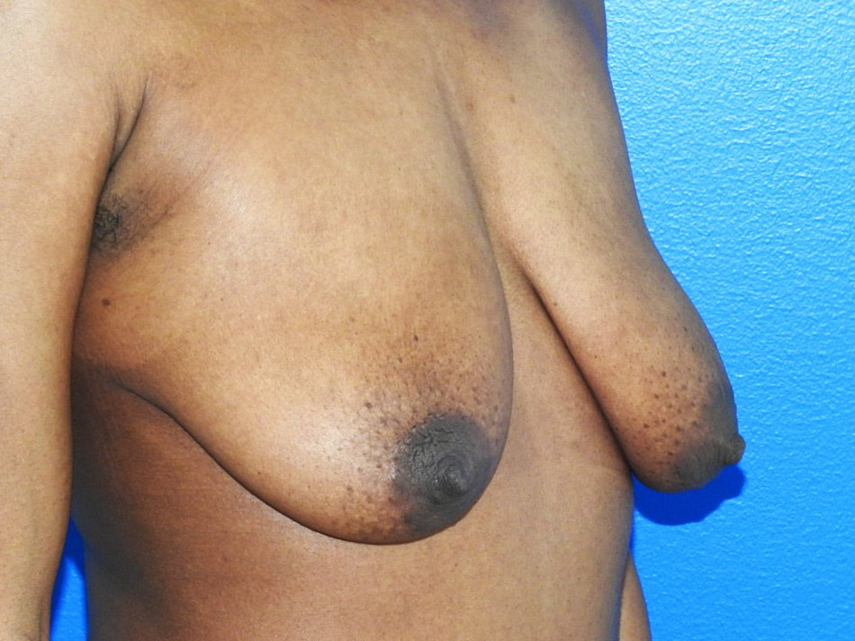 Before Image: Patient Case #0191 - right-front-oblique
